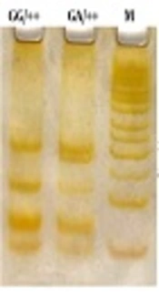 Association Between MspI Polymorphisms of the Apolipoprotein A-I Gene and Hyperlipidemia in an Iranian Population